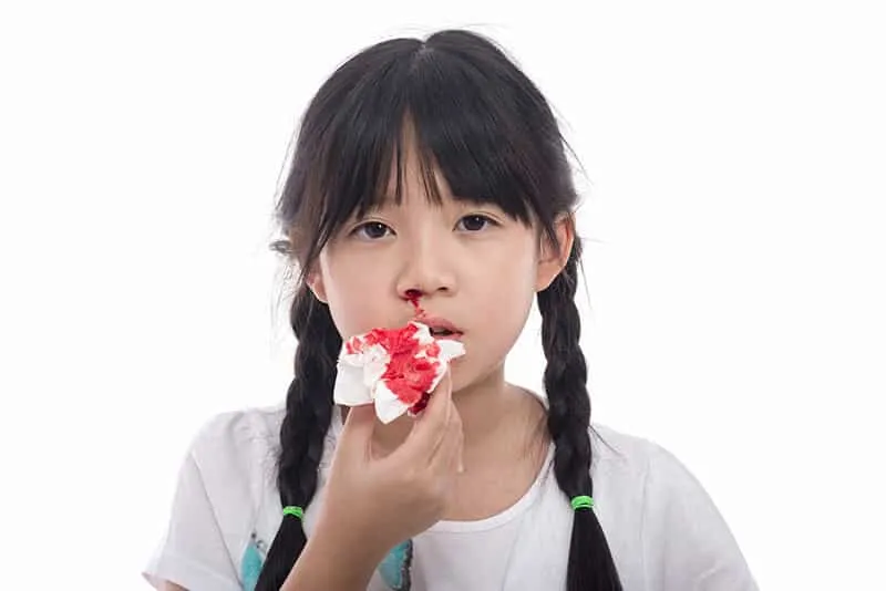 Chiêm bao chảy máu cam trong giấc mơ