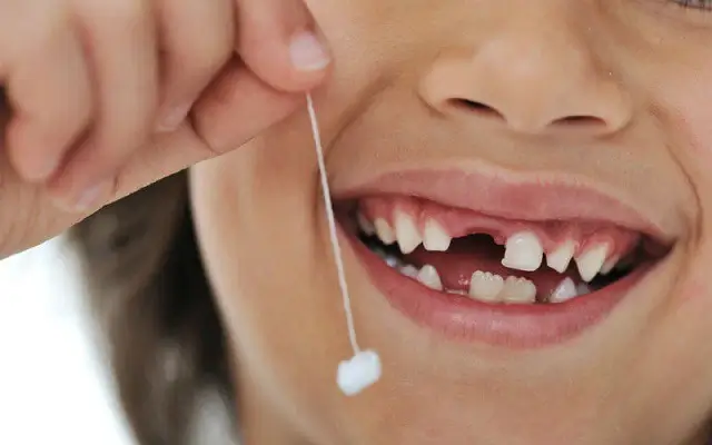 Mơ thấy rụng răng điềm báo gì