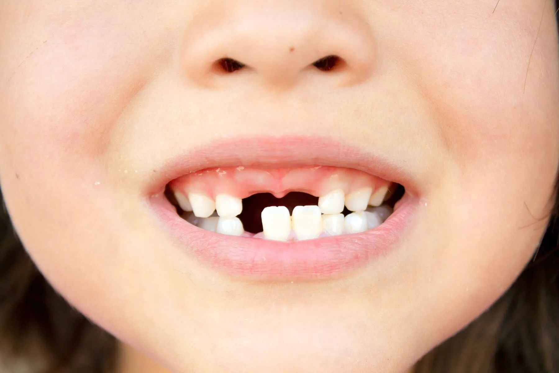 Ngủ mơ thấy rụng 3 cái răng