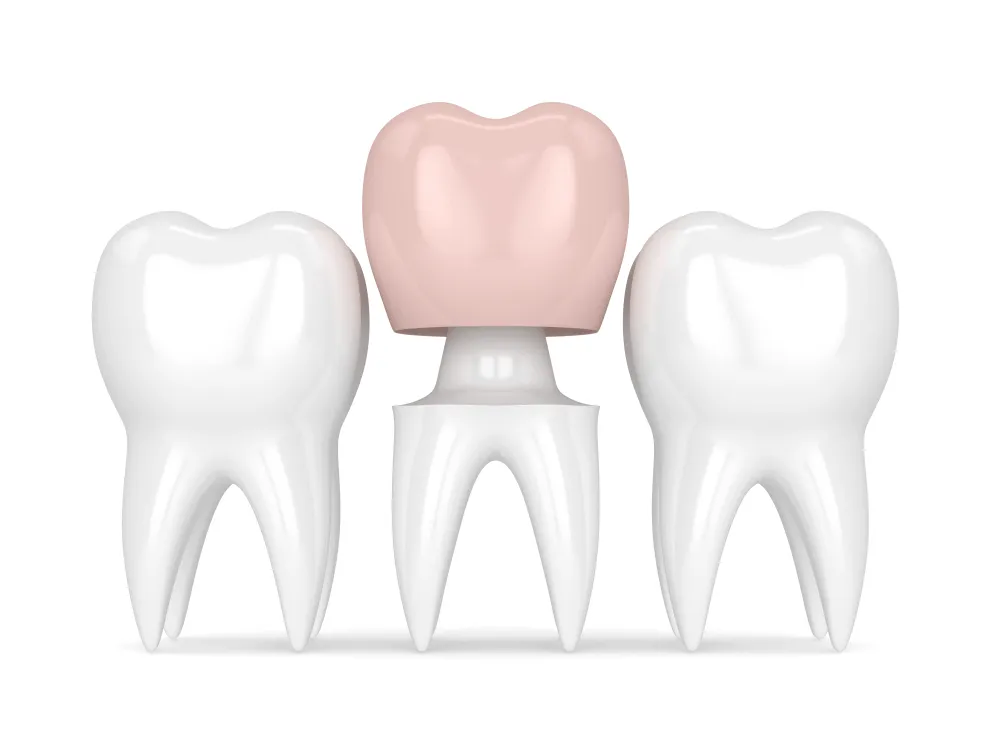 Mơ thấy phẩu thuật thẩm mỹ răng
