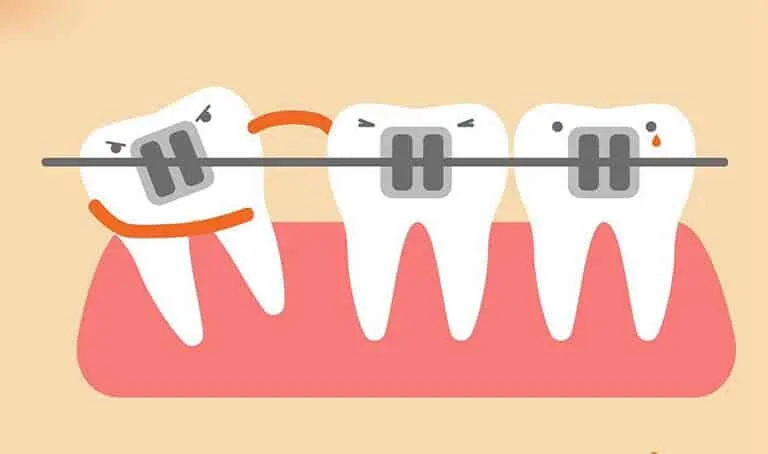 Nằm mơ thấy niềng răng đánh số mấy